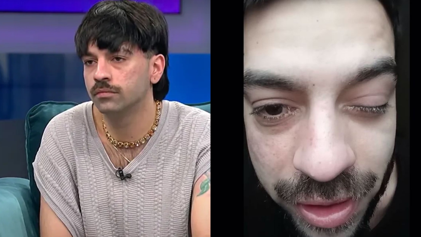 David Pușcaș s-a trezit cu ochiul umflat și a avut un șoc când s-a uitat în oglindă: ”Am vreo boală?”