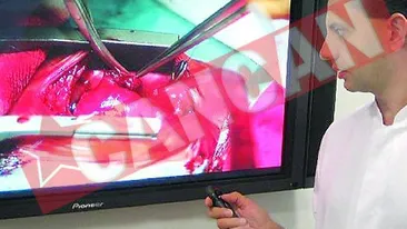 A operat pe cord un bebelus de 660 de grame