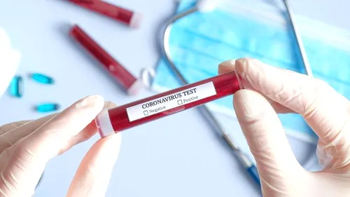Peste 2500 de teste pentru despistarea coronavirusului au fost confiscate la vamă, după ce un bucureștean a dat anunț pe internet că le vinde