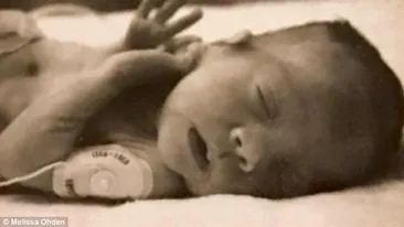 A fost avortată de mamă la 8 luni şi aruncată la gunoi, dar a supravieţuit! Cum arată acum femeia ajunsă la 40 de ani