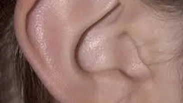 INCREDIBIL! Medicii au ramas fara replica cand s-au uitat in urechea acestui copil! Ce crestea acolo!