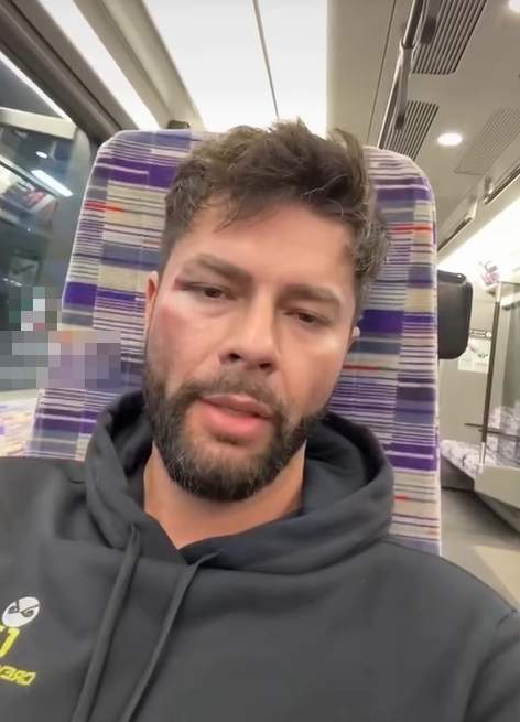 Ce a pățit ispita Andrew de la Insula Iubirii după ce și-a luat bătaie și a fost jefuit. Poliția din UK, atitudine rușinoasă