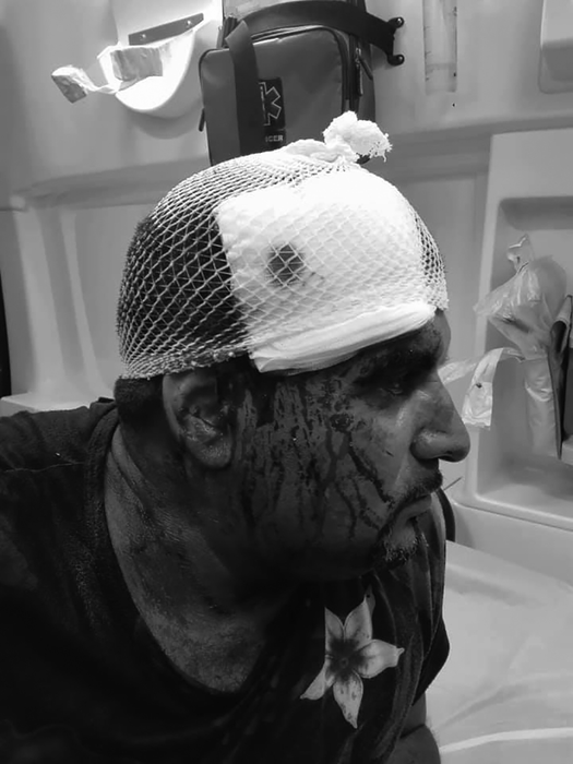 Victima a fost internată cu răni grave la cap