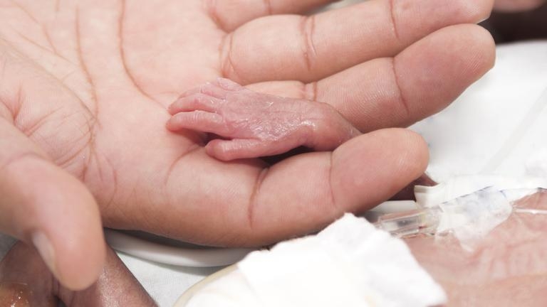 Lyla e cel mai prematur copil din lume. A fost născută în luna a cincea. Cum arată acum, după ce a crescut