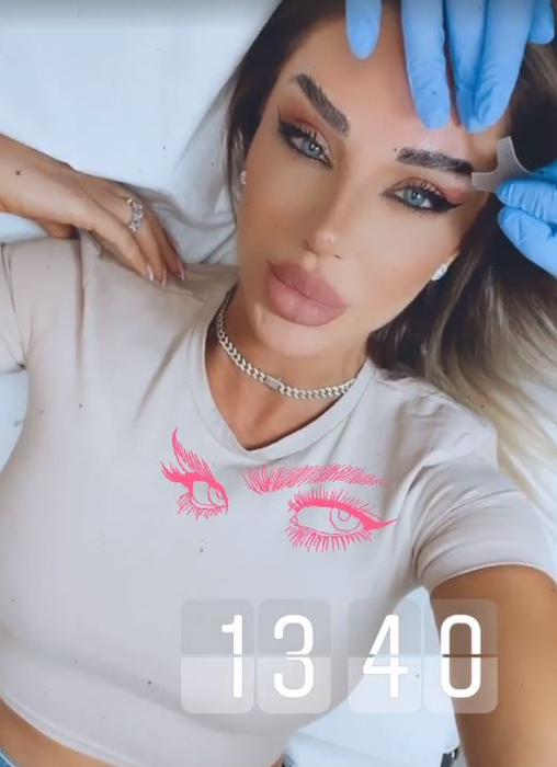 Bianca Drăgușanu, problemă delicată după o intervenție estetică: “Ce mi-o fi trebuit mie implant de sprâncene? O porcărie”