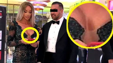Bianca Drăgușanu, cu o vânătaie imensă pe bust. A fost lovită în sâni?!