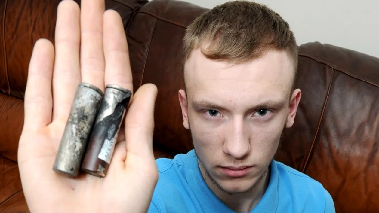Ştiai că ţi se poate întâmpla asta? Acest tânăr a suferit un accident horror, după ce ţigara electronică i-a explodat în buzunar | FOTO