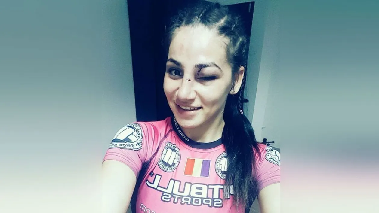 Diana Belbiţă, bătută măr la debutul în UFC. Vedeta de la Exatlon s-a pozat după loviturile puternice încasate și a spus ce face după meci