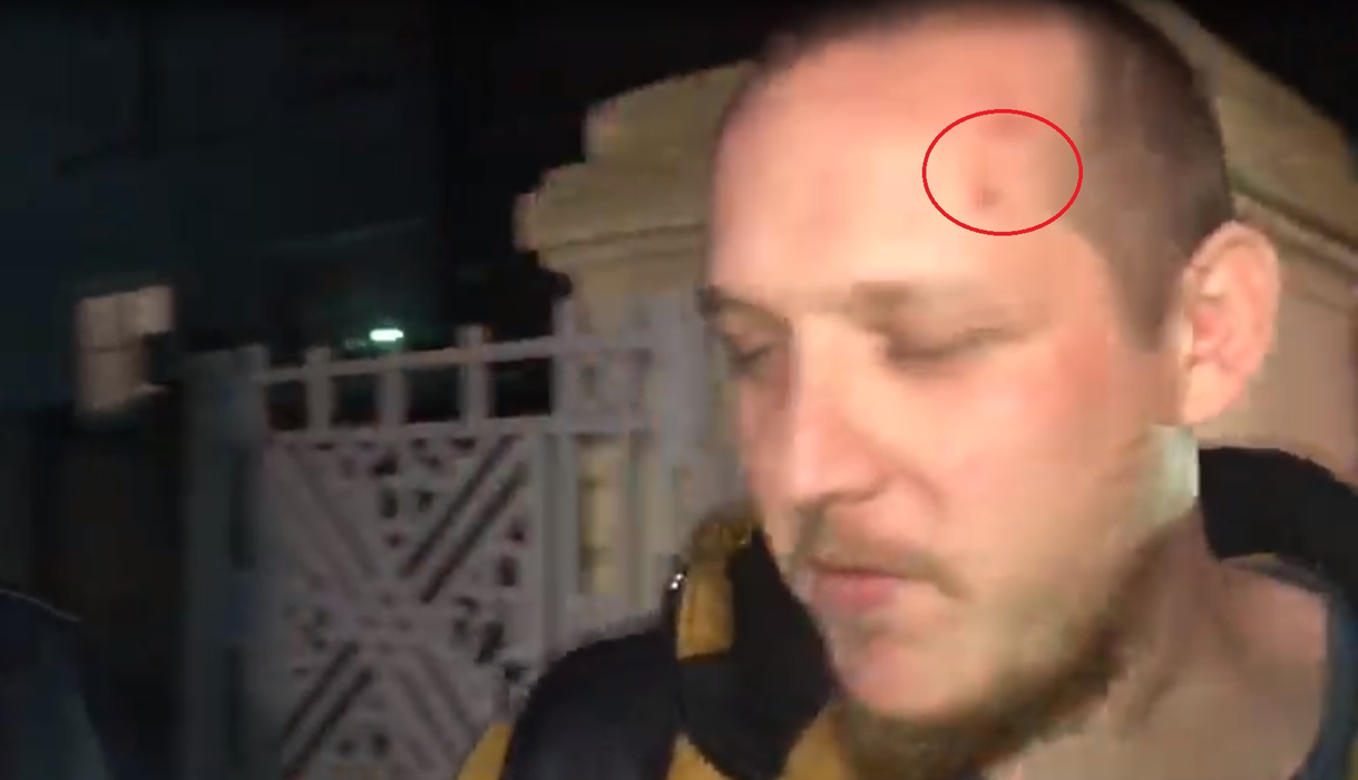 What’s Up, primele imagini după ce a fost audiat în urma scandalului cu iubita lui! Artistul are mai multe răni pe corp