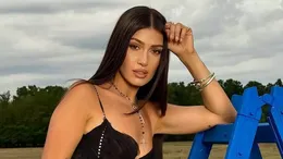 Alina Eremia și-a uimit fanii după ce a apărut cu fața umflată pe Instagram. Ce a pățit cântăreața în urmă cu puțin timp