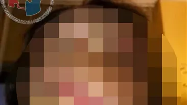 NIMENI nu se putea uita la chipul ei, pentru ca era DESFIGURATA! Cum arata ACUM tanara care semana cu un MONSTRU