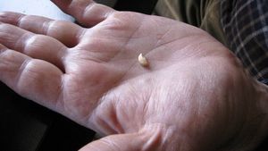 Este incredibil ce a putut sa pateasca un barbat de 70 de ani din Romania care a luat o pastila pentru potenta