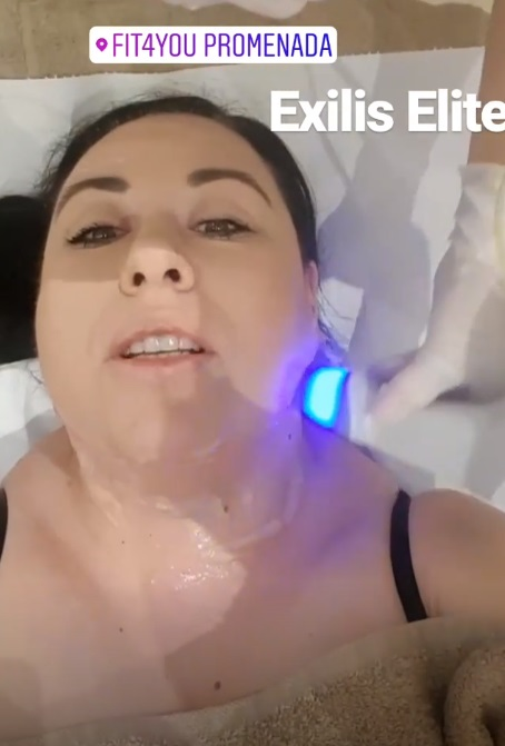 Oana Roman “și-a sculptat” fața! S-a filmat în timpul procedurii estetice