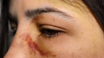 Fata bătută și umilită la Ploiești, declarații tulburătoare: 'Mi-a pus cuţitul l-a gât şi m-a tăiat'
