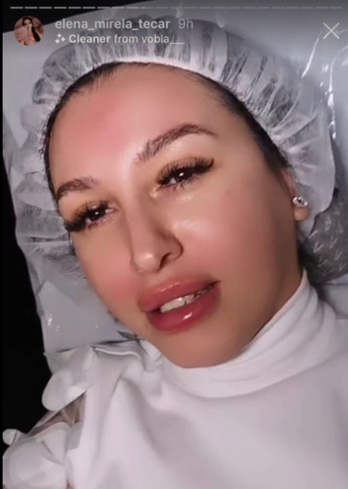 Cum arată Mirela de la Insula Iubirii după ce a devenit dependentă de operațiile estetice