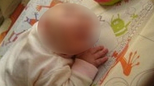 A fumat, a baut si a prizat cocaina in timpul sarcinii! Medicii au fost SOCATI cand au vazut cum arata bebelusul
