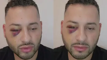 Mărturisiri crunte făcute de Daniel Balaș după episodul violent de pe litoral. Ce s-a întâmplat, de fapt, între fostul preot și bătăușii care l-au băgat în spital: ”Prostia mea a fost că...”