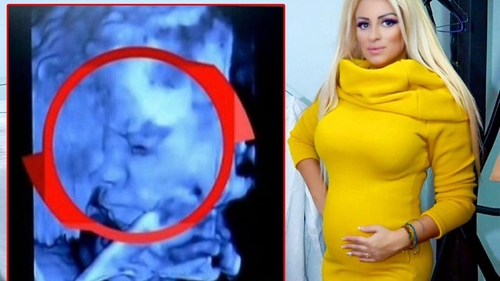 Sânziana Buruiană, însărcinată din nou?! A repostat poza cu ecografia: "Botoasa mică din burtică"