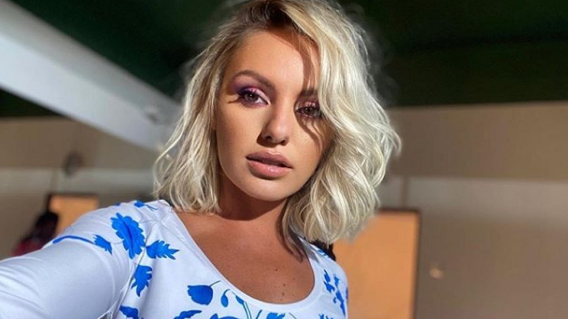 Imaginile care au îngrozit internetul. Alexandra Stan, plină de sânge pe față