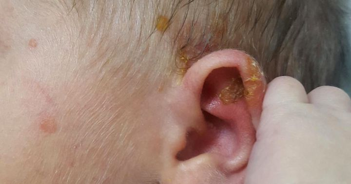 Mai mulți bebeluși au fost infectați la Maternitatea Giulești