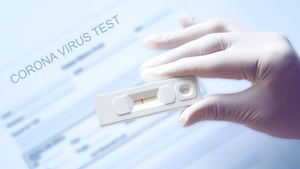 Coronavirus România, 6 august 2021. 230 de români s-au infectat, în ultimele 24 de ore, cu SARS-CoV-2