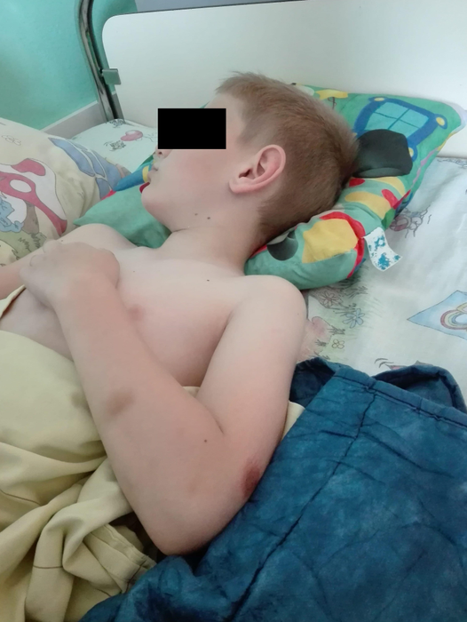Medicii spun că băiețelul a suferit mai multe leziuni Foto: RTV