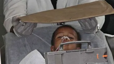 Baietelul strapuns de 30 de ace a fost operat