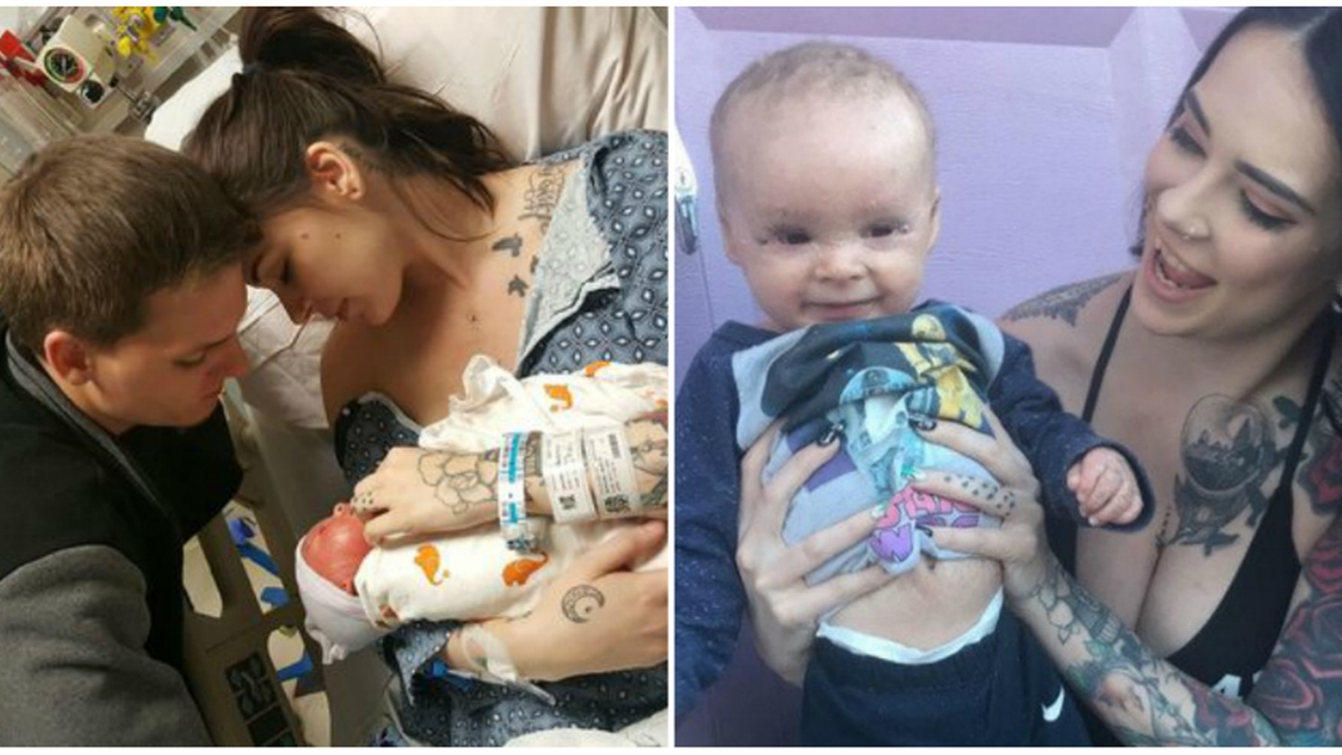 Bebelusul sufera de o boala rara si are dureri cumplite, dar mama lui a gasit o solutie INTERZISA pentru a-l vindeca. Ce spun medicii despre metoda femeii
