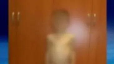 Tortura si infometare, pentru un copil din Cehia! La 7 ani cantareste doar 13 kilograme!