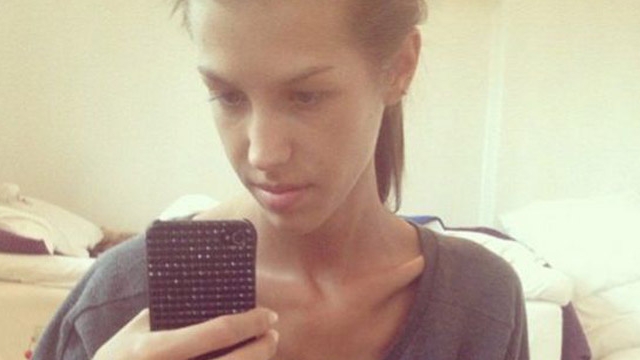 Era atat de slaba incat oamenii se speriau de ea! Cum arata dupa ce a stat doua luni in spital si s-a insanatosit