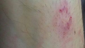 Un poliţist doljean aflat în misiune a fost muşcat de un fost deţinut