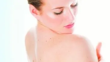 Tot ce trebuie sa stii despre melanom. Cum sa prevenim cancerul de piele