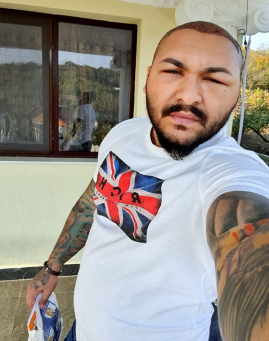 Dani Mocanu, probleme după implantul de păr
