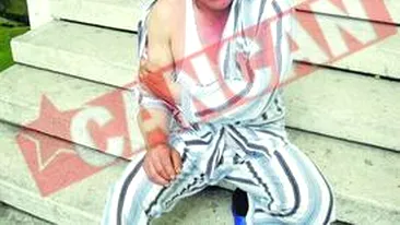 Lovit cu bata si cu sapa de viceprimar