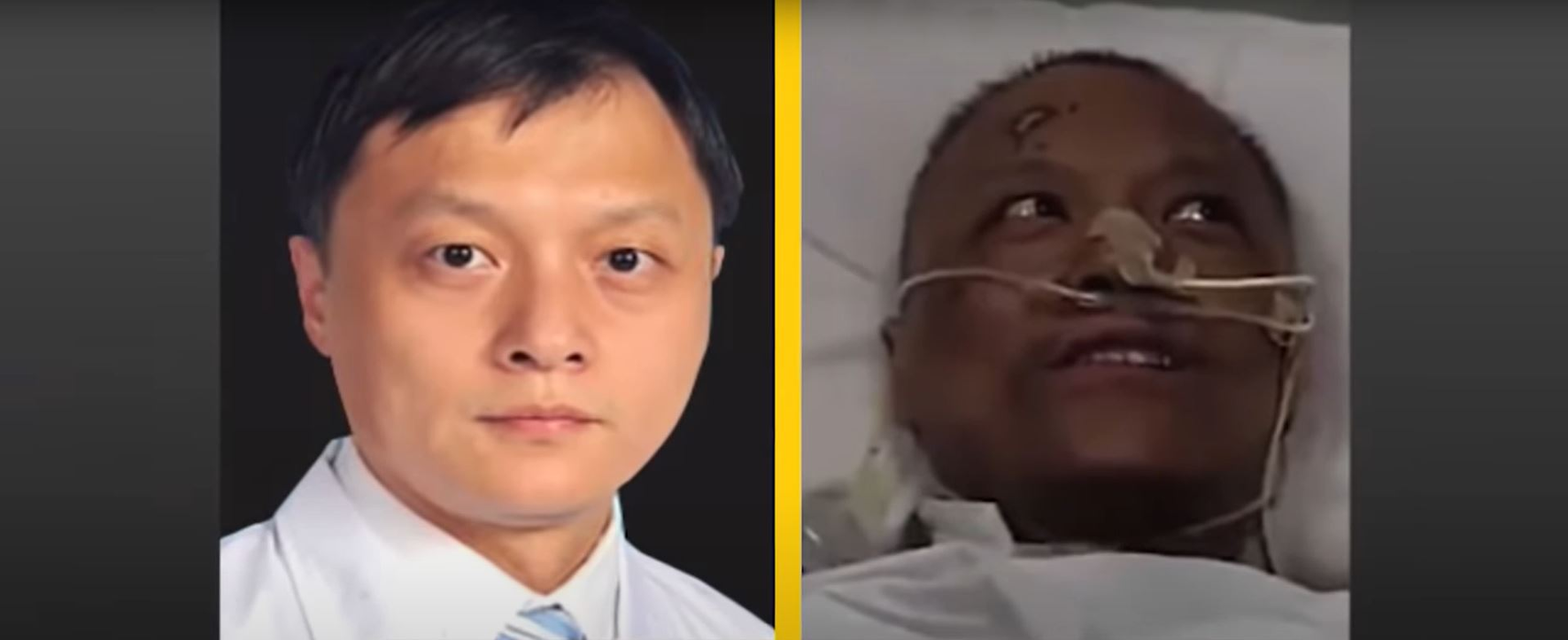 Incredibil! Infectați cu noul coronavirus, doi medici chinezi s-au trezit cu pielea închisă la culoare! Explicațiile specialiștilor