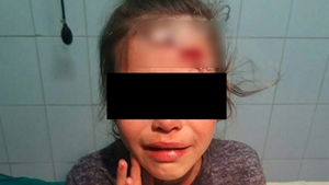 O fetiță din Călărași a ajuns la spital cu capul spart, după ce patroana unui magazin ar fi lovit-o cu un borcan de bulion