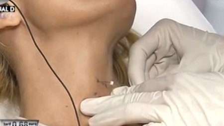 Ti se face pielea de găină! Daniela Gyorfi s-a lăsat injectată în gât in direct! "Sper să nu ajung ca Michael Jackson"