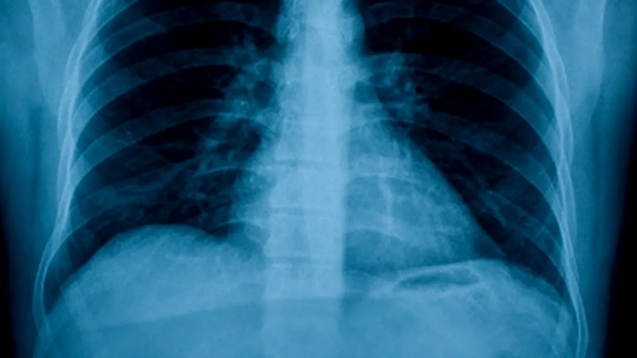 Reactia scandaloasa a medicilor romani dupa ce au ramas socati in fata acestei radiografii. Ce au vazut in ea