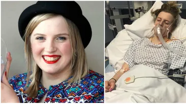 Femeia asta e alergica la orice, chiar si la ea! E infricosator cum reactioneaza atunci cand isi simte propriile lacrimi