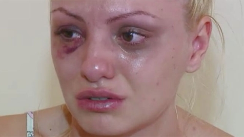 Medicii i-au interzis Alexandrei Stan sa mai urce pe scena. Avocatul artistei: "Va cauta ajutor in strainatate"