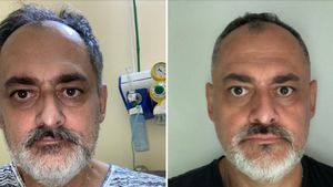 Cu ce sechele a rămas un român, la un an de când s-a vindecat de COVID-19: ”Nu este o glumă!”