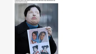 O iranianca se va razbuna pe fostul iubit pentru ca a desfigurat-o