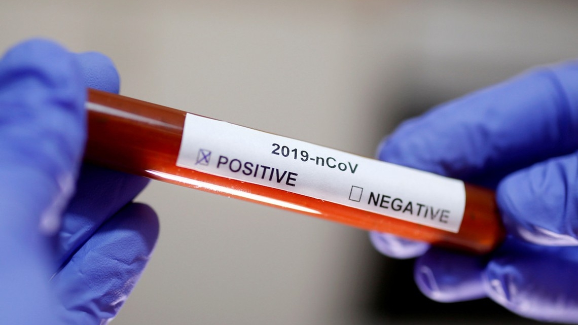 Numărul deceselor cauzate de coronavirus în SUA a crescut din nou!
