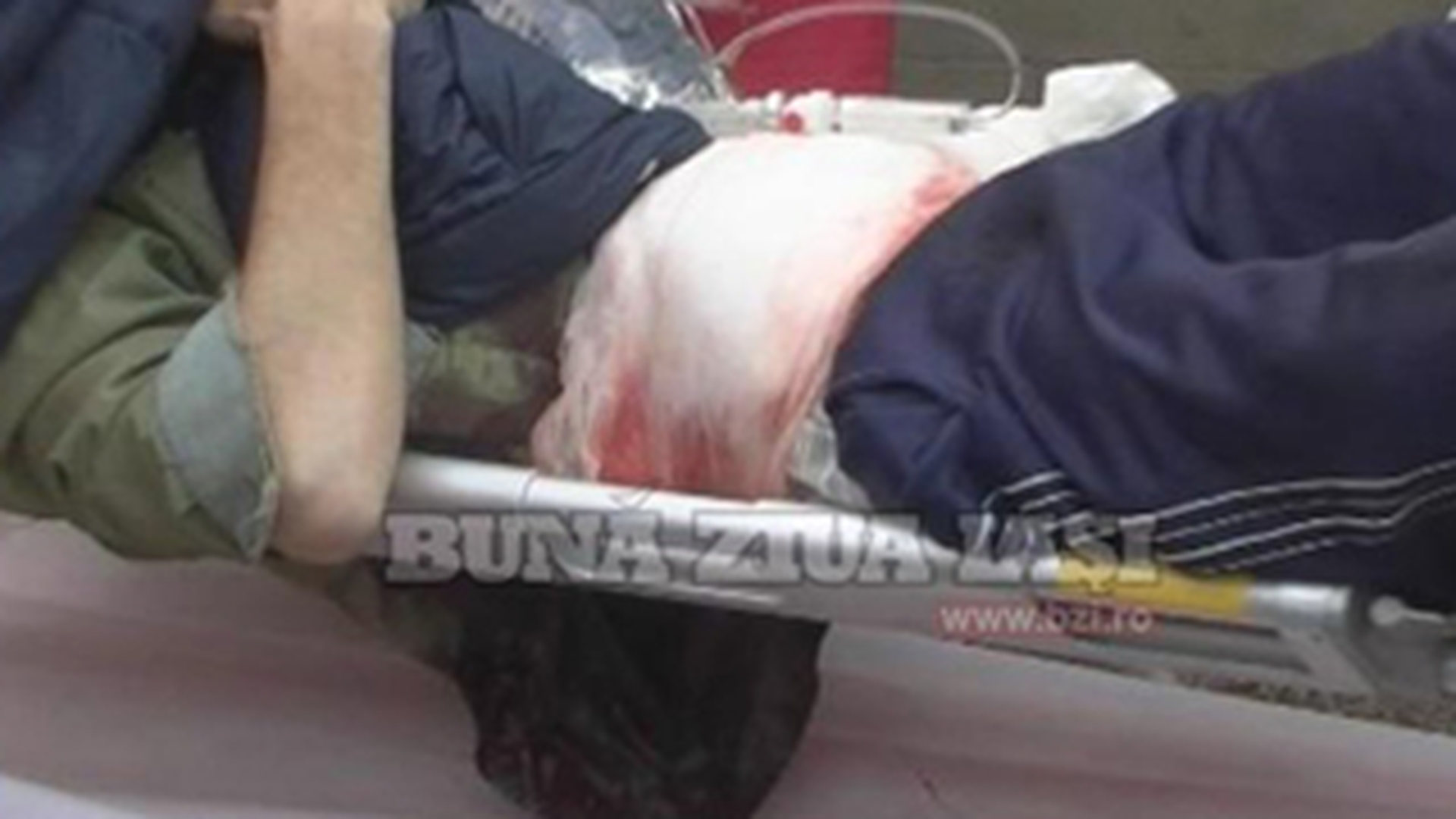 Un barbat de 44 de ani nu a mai suportat singuratatea si si-a scos intestinele!