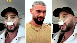 Dorian Popa și-a dat bandajele de la nas jos: „Am plâns ca un bebeluș.” Care este motivul?