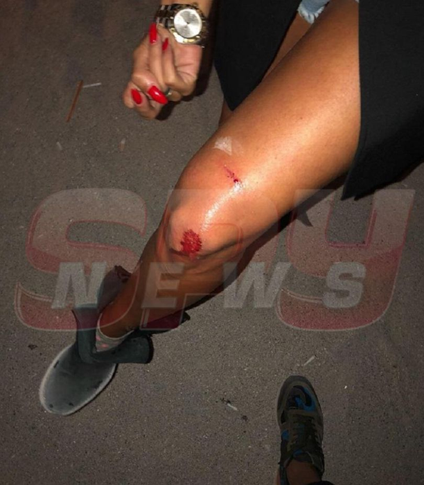 Maria Simion, implicată într-un accident pe litoral! A ajuns pe mâna medicilor