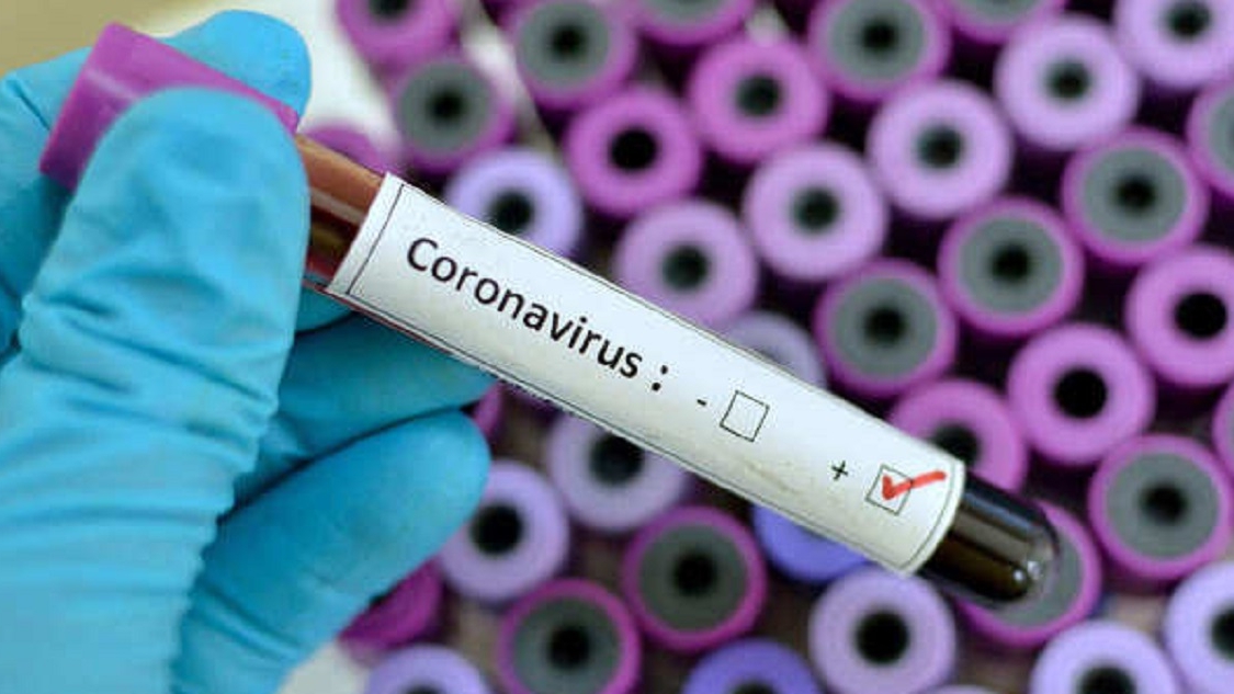 Bilanțul românilor din străinătate infectați cu coronavirus. Covid-19 a ucis 11 persoane, până în prezent!