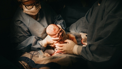Incredibil! O femeie de 40 de ani cu sarcină extrauterină a născut un copil sănătos, deși sarcina s-a dezvoltat în abdomen