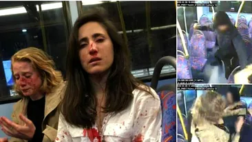 Două tinere au fost desfigurate în bătaie pentru că nu au vrut să facă amor în autobuz: ”Sub mine, pe podea, începuse să se formeze o baltă de sânge”