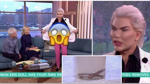 Rodrigo Alves si-a scos COASTELE! Cum arata acum Papusa Umana Ken si de ce a facut-o. Motivul este ireal de STUPID!!!